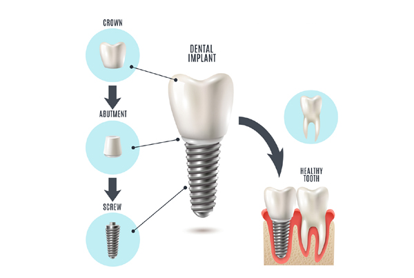 ...